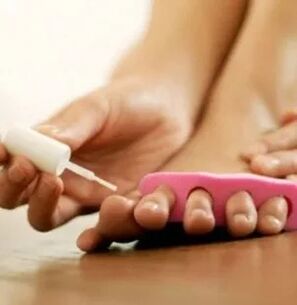 Therapeutic varnish application